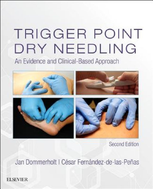 Trigger Point Dry Needling: An Evidence and Clinical-Based Approach by Jan Dommerholt