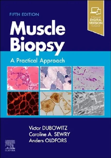 Muscle Biopsy: A Practical Approach by Victor Dubowitz