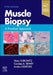 Muscle Biopsy: A Practical Approach by Victor Dubowitz