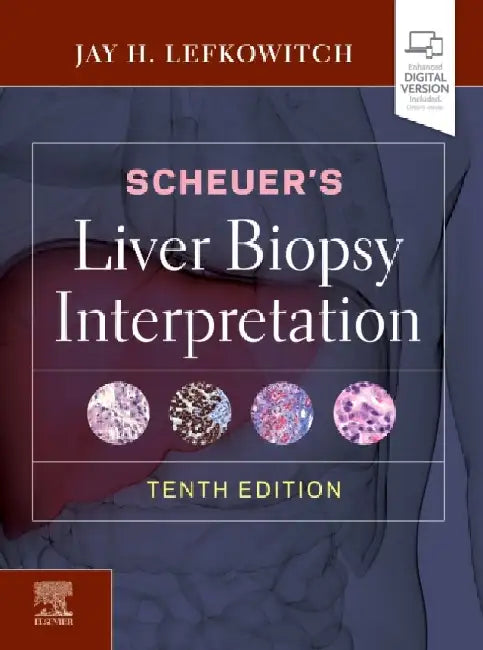 Scheuer's Liver Biopsy Interpretation by Jay H. Lefkowitch