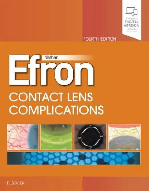 Contact Lens Complications by Nathan Efron