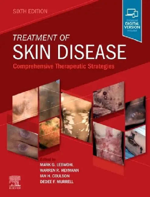 Treatment of Skin Disease: Comprehensive Therapeutic Strategies by Mark G. Lebwohl