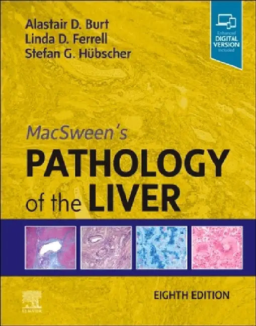 Macsween's Pathology of the Liver by Alastair D. Burt