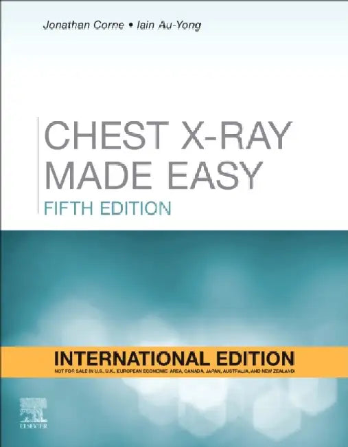 Chest X Ray Made Easy 5e by Corne J