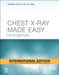 Chest X Ray Made Easy 5e by Corne J