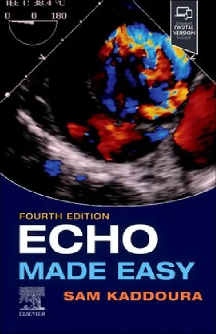 Echo Made Easy by Sam Kaddoura