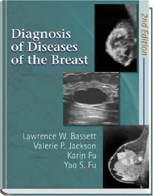 Diagnosis of Diseases of the Breast, 2e by Bassett