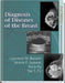 Diagnosis of Diseases of the Breast, 2e by Bassett