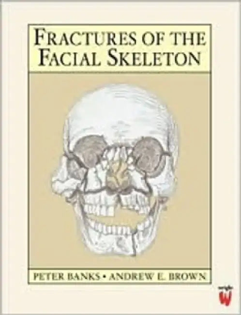 Fractures of the Facial Skeleton by Banks