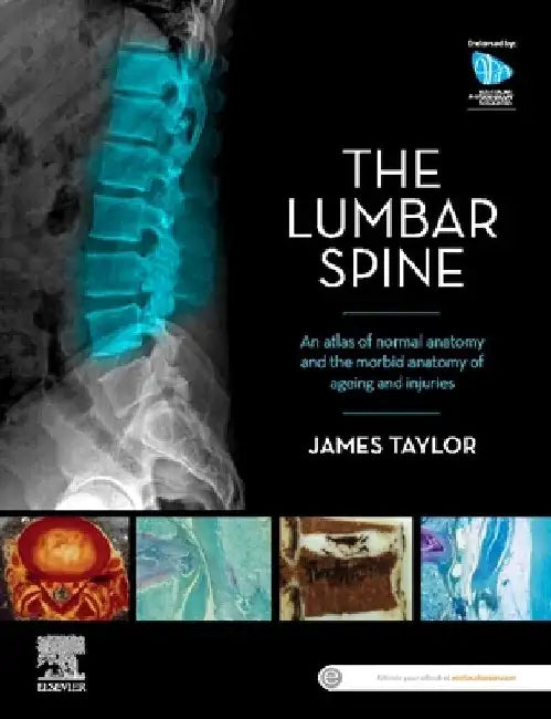 Anatomy of the Lumbar Spine: An Atlas of Normal Anatomy and the Morbid Anatomy of Ageing and Injury by James Taylor