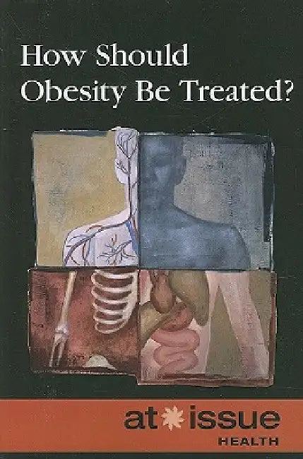 How Should Obesity Be Treated? by Stefan Kiesbye
