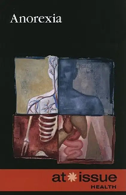 Anorexia by Stefan Kiesbye