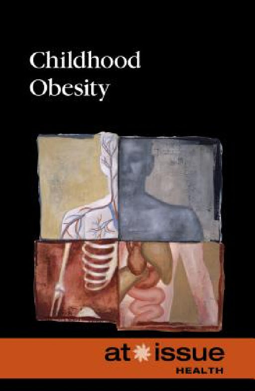 Childhood Obesity by Tamara Thompson