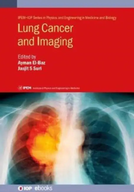 Lung Cancer and Imaging by Ayman El-Baz, Jasjit S. Suri, Ahmed Shaffie