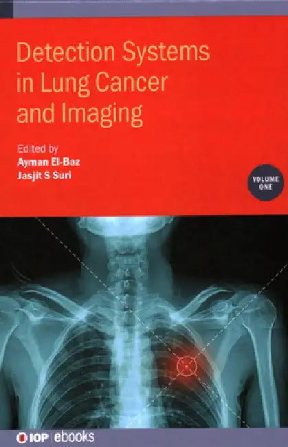 Detection Systems in Lung Cancer and Imaging by Ayman El-Baz