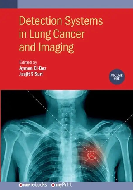 Detection Systems In Lung Cancer And Imaging Volume 1 by Ayman El-Baz