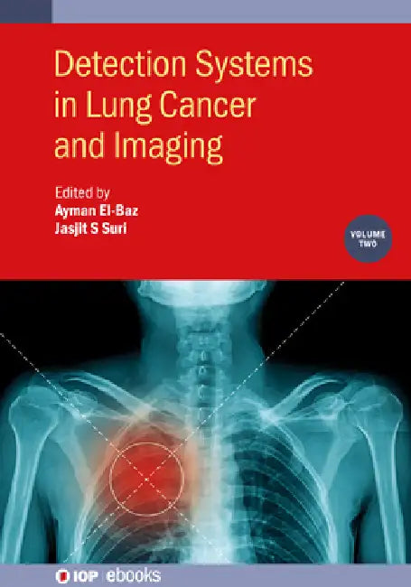 Detection Systems in Lung Cancer and Imaging, Volume 2 by Ayman El-Baz, Jasjit S. Suri