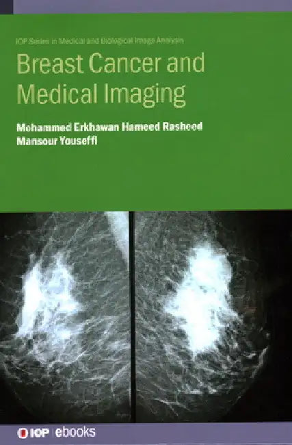 Breast Cancer and Medical Imaging by Mohammed Erkhawan Hameed Rasheed