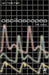 Oscilloscopes by Hickman, Ian
