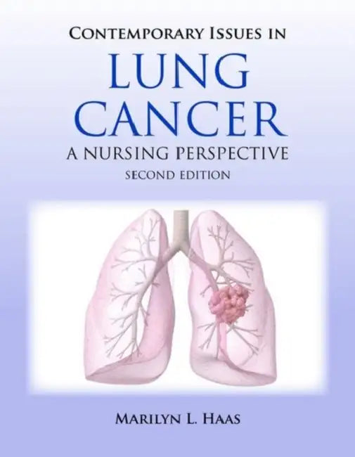 Contemporary Issues in Lung Cancer: . by Marilyn Haas