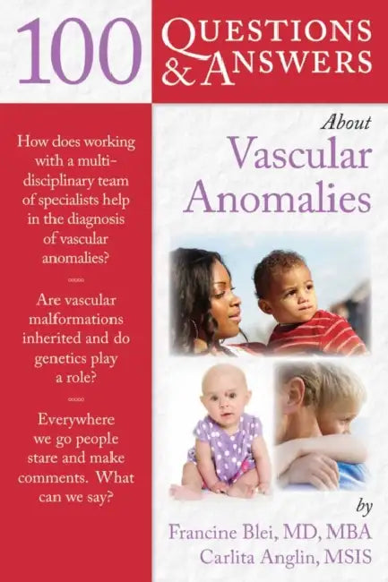 100 Question & Answers about Vascular Anomalies by Francine Blei, Carlita Anglin