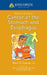 Johns Hopkins Patients' Guide to Cancer of the Stomach and Esophagus by Mark D. Duncan