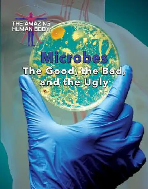 Microbes: The Good, the Bad, and the Ugly by Joanne Randolph