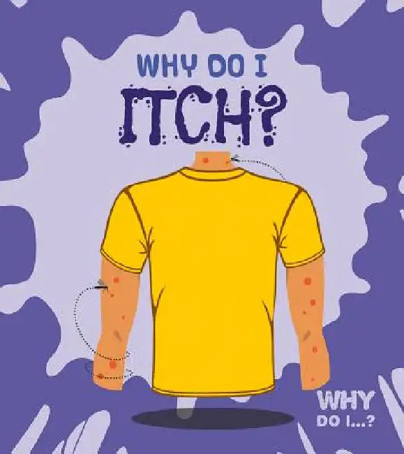 Why Do I Itch? by Madeline Tyler