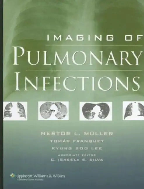 Imaging of Pulmonary Infections by Nestor L. Muller