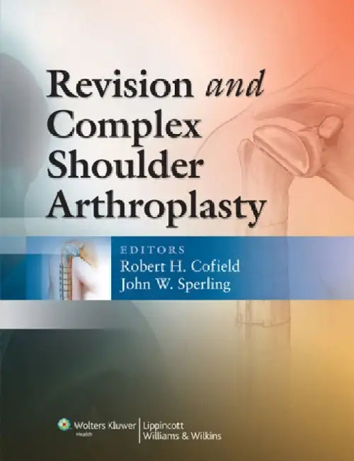Revision and Complex Shoulder Arthroplasty by Quintin Jardine