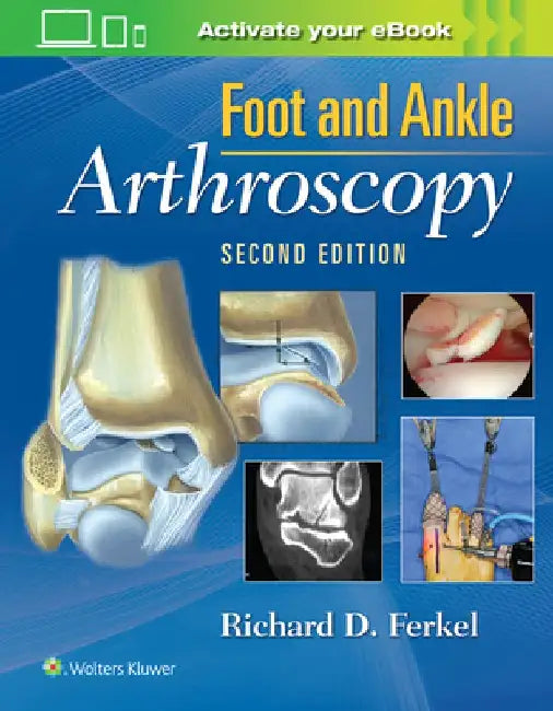 Foot & Ankle Arthroscopy by Richard D. Ferkel