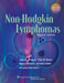 Non-Hodgkin Lymphomas, 2e by Armitage