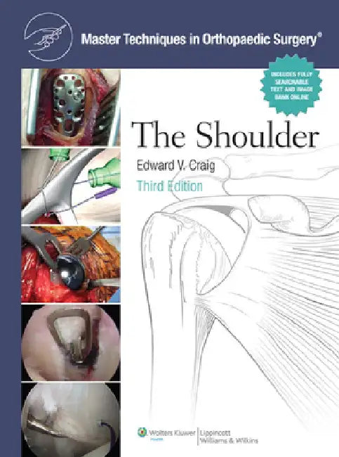 Master Techniques in Orthopaedic Surgery: Shoulder by Edward V. Craig