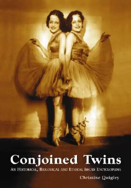 Conjoined Twins: An Historical, Biological and Ethical Issues Encyclopedia by Christine Quigley
