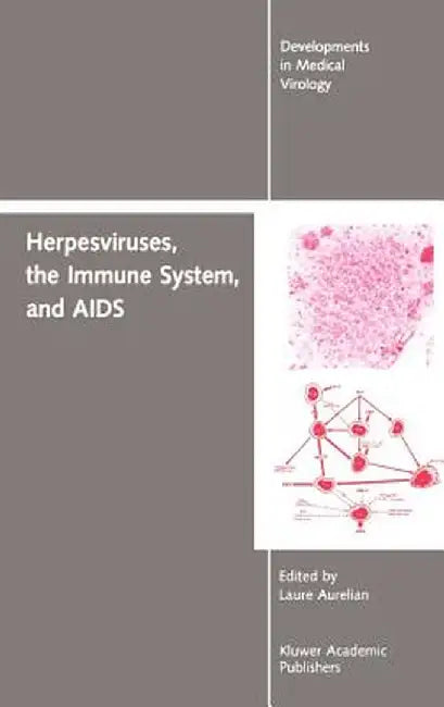 Herpesviruses, the Immune System, and AIDS by Yechiel Becker