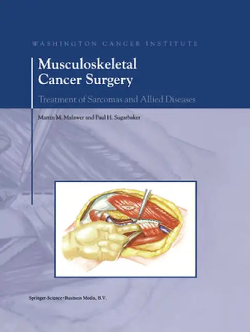 Musculoskeletal Cancer Surgery: Treatment of Sarcomas and Allied Diseases by Martin M. Malawer