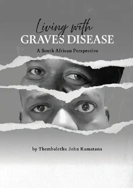 Living with Graves Disease: A South African Perspective by Thembalethu Kumatana