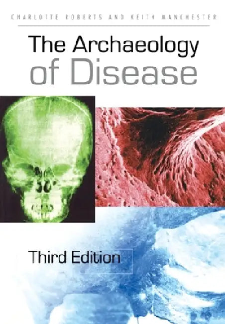 The Archaeology of Disease by Charlotte A. Roberts, Keith Manchester