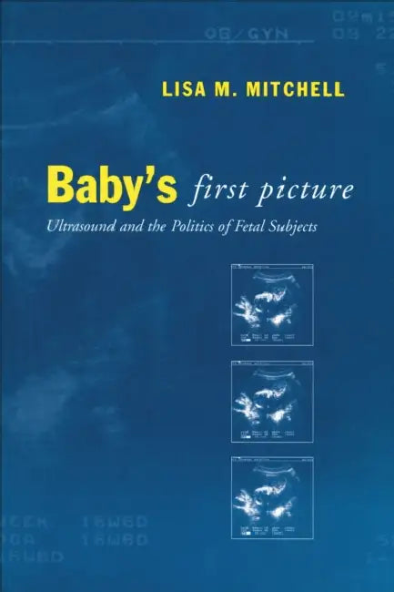 Baby's First Picture: Ultrasound and the Politics of Fetal Subjects by Lisa M. Mitchell