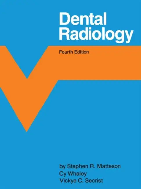 Dental Radiology by Stephen R. Matteson, Cy Whaley, Vickye C. Secrist