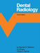 Dental Radiology by Stephen R. Matteson, Cy Whaley, Vickye C. Secrist