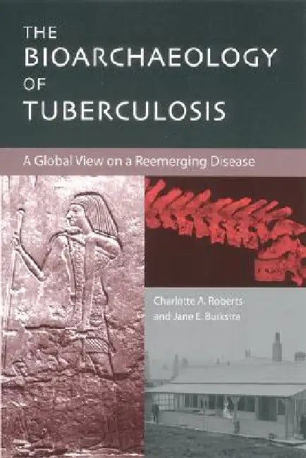 The Bioarchaeology of Tuberculosis: A Global View on a Reemerging Disease by Charlotte A. Roberts, Jane E. Buikstra