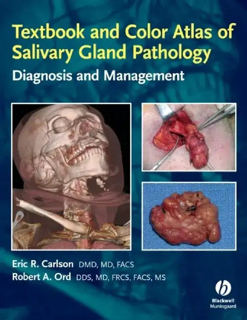 Textbook and Color Atlas of Salivary Gland Pathology: Diagnosis and Management by Eric R. Carlson, Robert Ord
