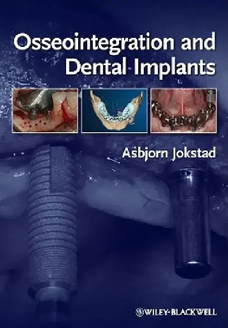 Osseointegration and Dental Implants by Asbjorn Jokstad