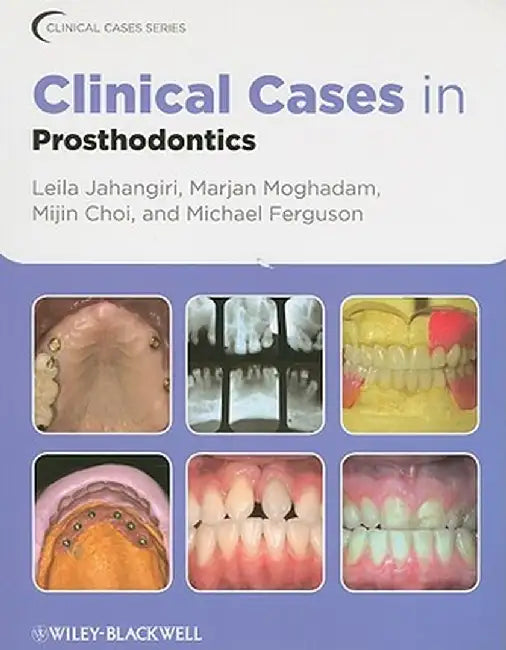 Clinical Cases in Prosthodontics by Leila Jahangiri