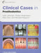 Clinical Cases in Prosthodontics by Leila Jahangiri