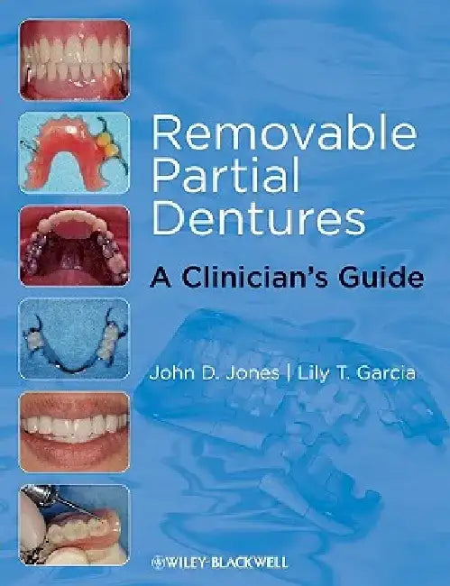 Removable Partial Dentures: A Clinician's Guide by John D. Jones