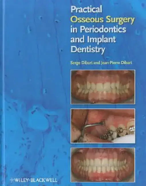 Practical Osseous Surgery in Periodontics and Implant Dentistry by Serge Dibart