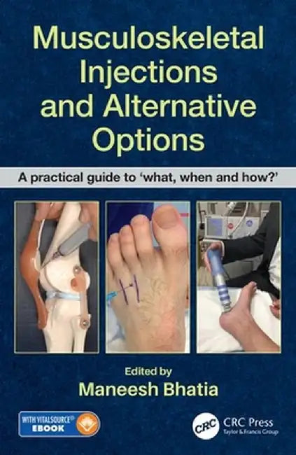 Musculoskeletal Injections and Alternative Options: A Practical Guide to 'What, When and How?' [With eBook] by Maneesh Bhatia