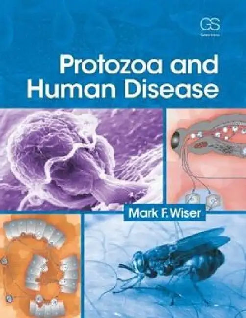 Protozoa and Human Disease by Mark F. Wiser